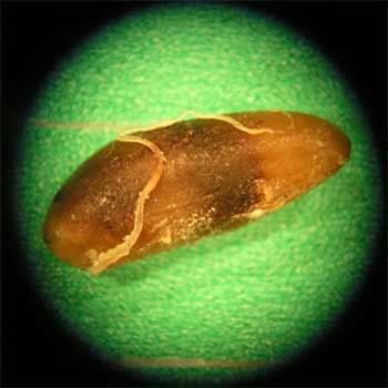 Foreign Body Analysis